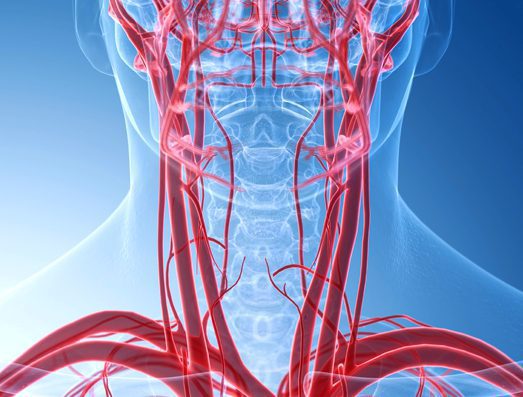 carolina-cardiology-associates-carotid-arteries